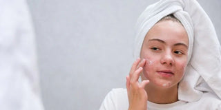 Comment enlever les rougeurs du visage rapidement et naturellement ?