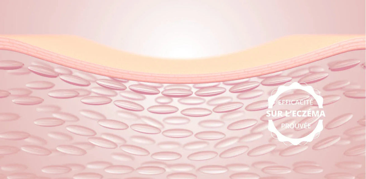 EVALUATION DES PRODUITS DERMO-COSMETIQUES REJENCE SUR LES PROPRIETES BIO-MECANIQUES DE L'EPIDERME SIGNANT LA DERMATITE ATOPIQUE