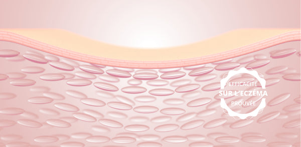 EVALUATION DES PRODUITS DERMO-COSMETIQUES REJENCE SUR LES PROPRIETES BIO-MECANIQUES DE L'EPIDERME SIGNANT LA DERMATITE ATOPIQUE