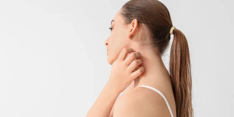 Dermite séborrhéique ou psoriasis : faire la différence pour mieux agir !
