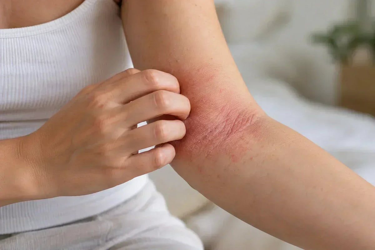 Eczéma du coude : pourquoi apparaît-il et comment l’apaiser ?