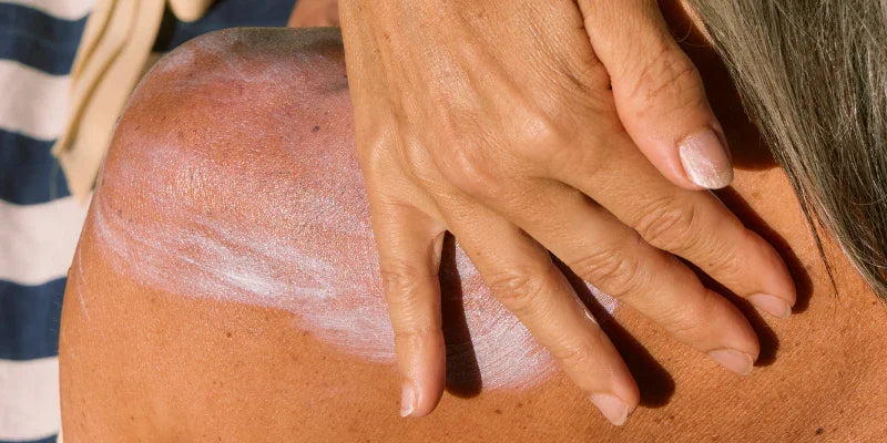 Hydrater sa peau durant l'été