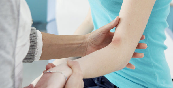 Ma Peau et l'Eczéma - Causes et Traitements Naturels