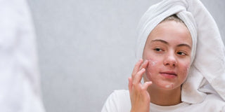 Comment enlever les rougeurs du visage rapidement et naturellement ?