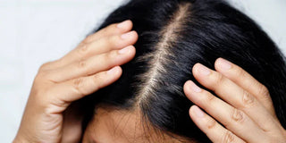 Démangeaison du cuir chevelu : causes et solutions naturelles pour soulager