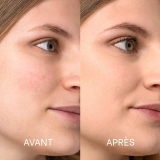 Routine visage anti-rougeurs SPF30