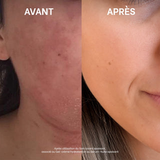 Soin lavant apaisant - 250mL