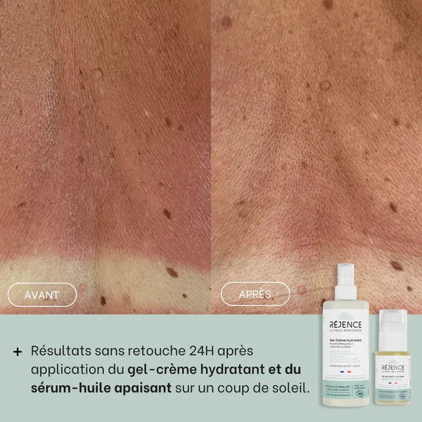 Duo après-soleil
