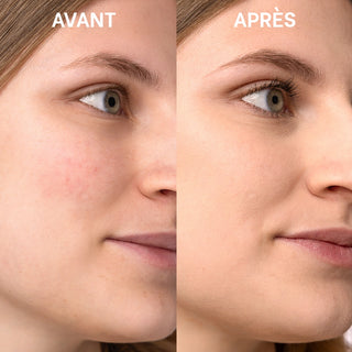 Soin correcteur de teint apaisant - SPF30