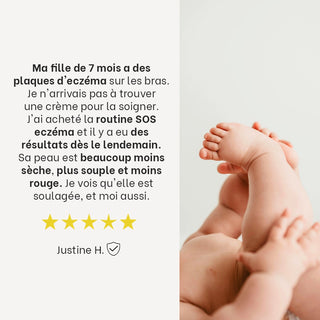 Avis client cinq étoiles sur la routine SOS eczéma bébé Réjence accompagné d'une photo des jambes d'un bébé, mettant en avant l'amélioration des plaques d'eczéma et des rougeurs.