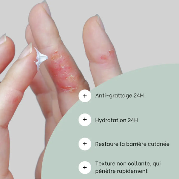 Routine eczéma des mains