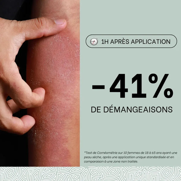 Trio crèmes eczéma