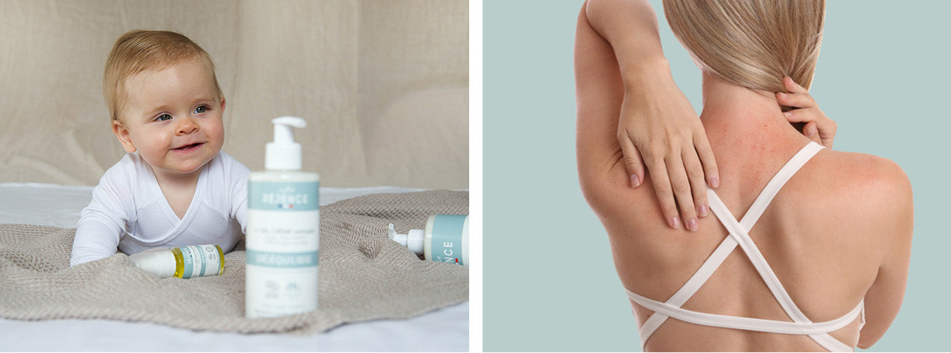 Peau atopique et eczéma