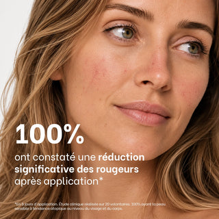 Gros plan sur le visage d'une femme présentant des vaisseaux sanguins visibles, illustrant la réduction visible des rougeurs après utilisation des soins anti-rougeurs Réjence.