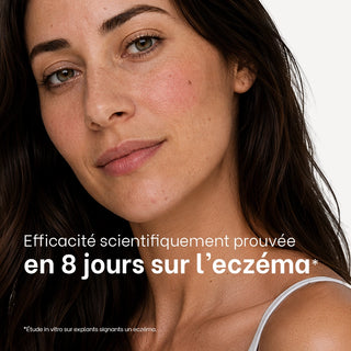 Visage de femme avec la notion "efficacité scientifiquement prouvée en 8 jours sur l'eczéma"
